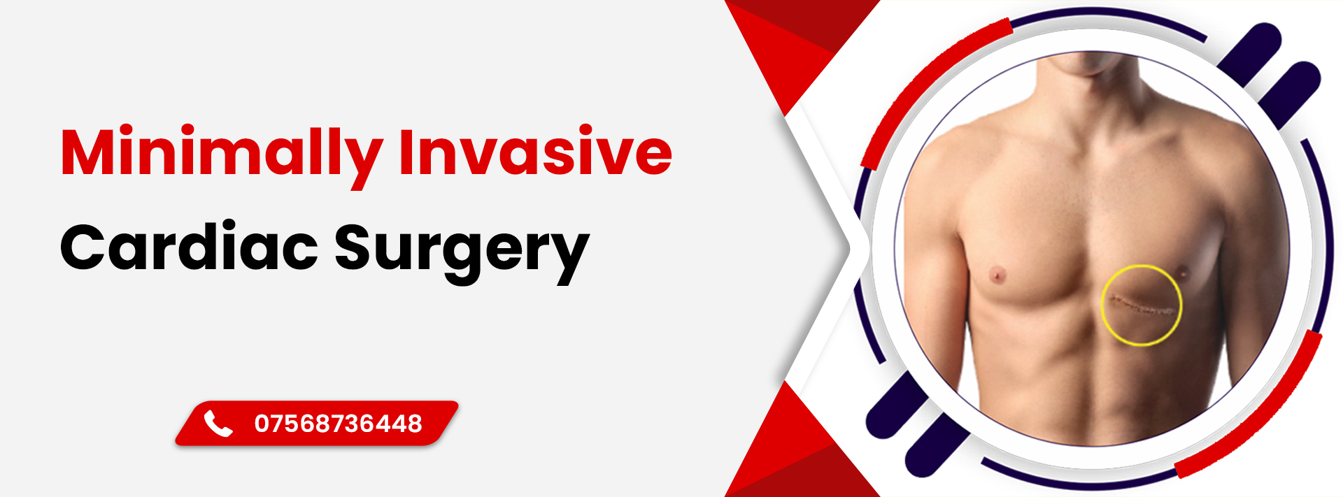 Cardiac surgeon in Jaipur