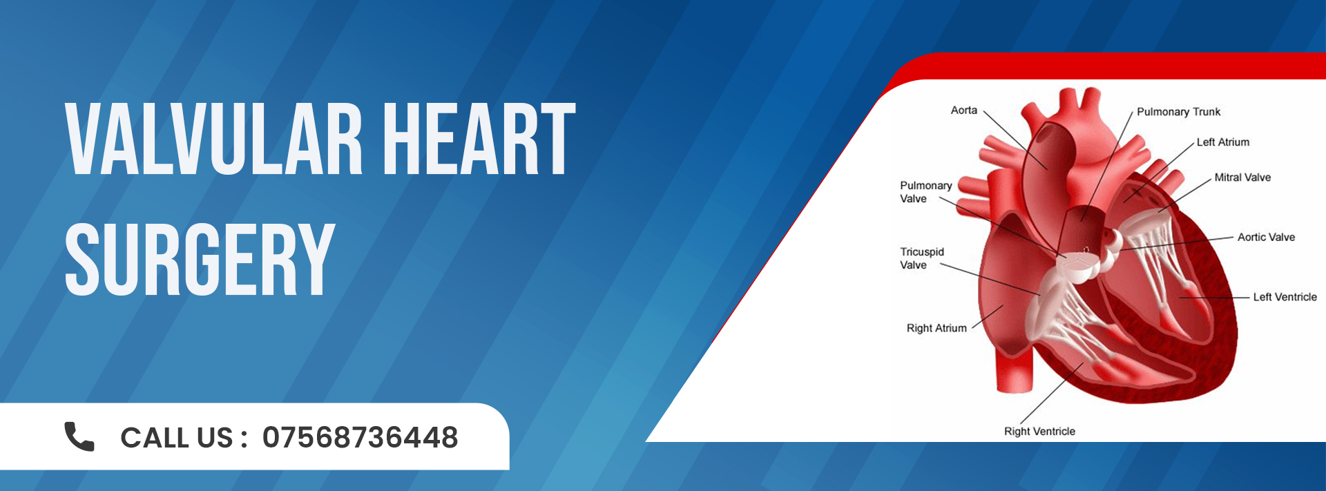 Cardiac surgeon in Jaipur